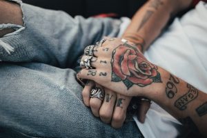 All You Need to Know about Tattoo Removal